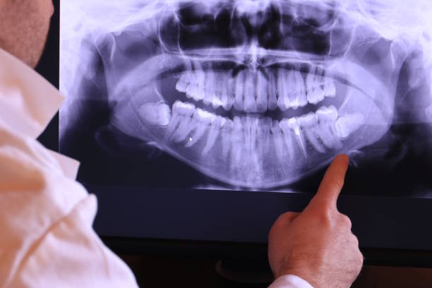 Best Dentist for Tooth Abscess  in Olathe, CO
