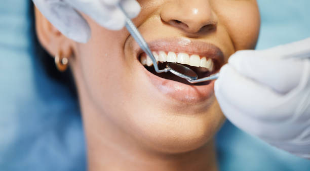 Best Affordable Emergency Dental Care  in Olathe, CO